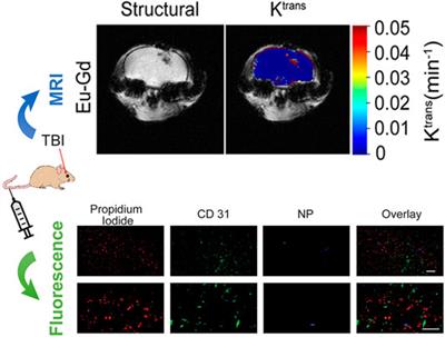 Recent Advances in Fluorescence Imaging of Traumatic Brain Injury in Animal Models